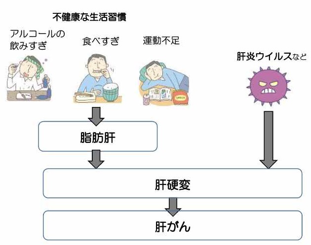 肝疾患の進行